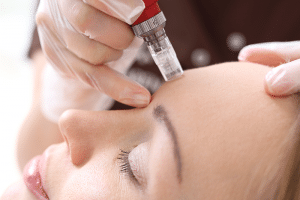 tratamientos faciales con mesoterapia virtual