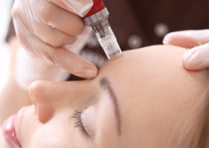 tratamientos faciales con mesoterapia virtual