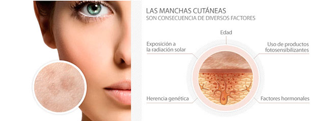 Tratamientos de manchas en la piel en Belleza y Salud MariFe, Alaquàs, Valencia.
